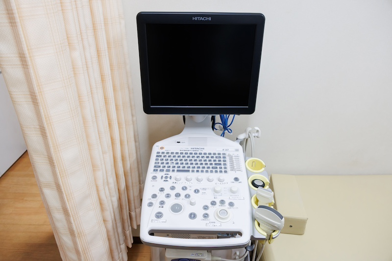 超音波検査装置（エコー）
