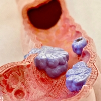 日帰り大腸ポリープ切除に対応